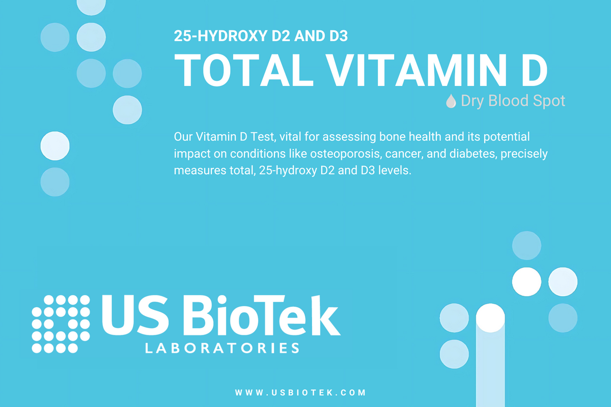 Vitamin D - US Biotek, 25- Hydroxy